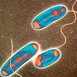 legionella pneumophila